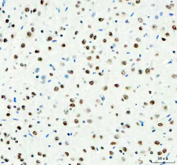 DDX1 Mouse Monoclonal Antibody