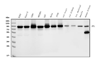 DDX1 Mouse Monoclonal Antibody