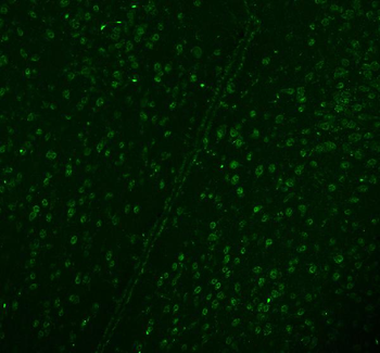 DDX1 Mouse Monoclonal Antibody