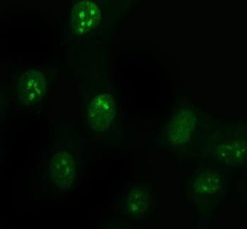 DDX1 Mouse Monoclonal Antibody