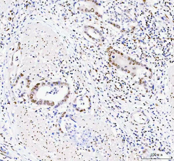 DDX1 Mouse Monoclonal Antibody