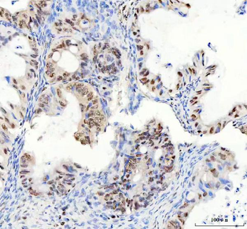 DDX1 Mouse Monoclonal Antibody