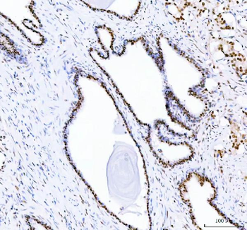 DDX1 Mouse Monoclonal Antibody