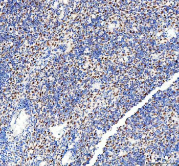 DDX1 Mouse Monoclonal Antibody