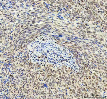DDX1 Mouse Monoclonal Antibody