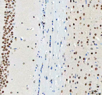 DDX1 Mouse Monoclonal Antibody