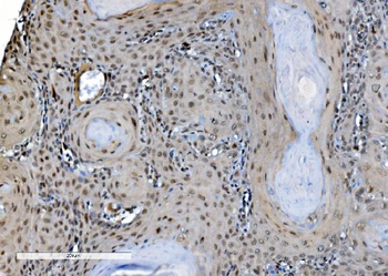 DDX1 Mouse Monoclonal Antibody