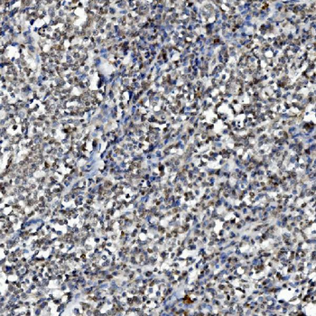 DDX1 Mouse Monoclonal Antibody