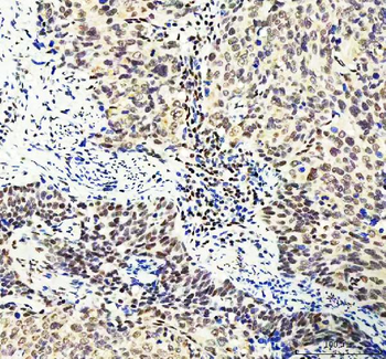 DDX1 Mouse Monoclonal Antibody