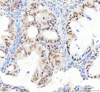 DDX1 Mouse Monoclonal Antibody