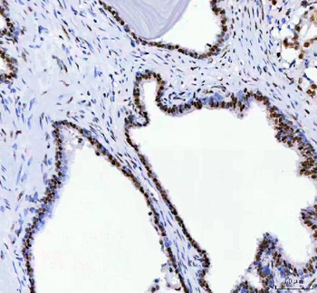 DDX1 Mouse Monoclonal Antibody