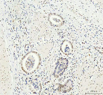 DDX1 Mouse Monoclonal Antibody
