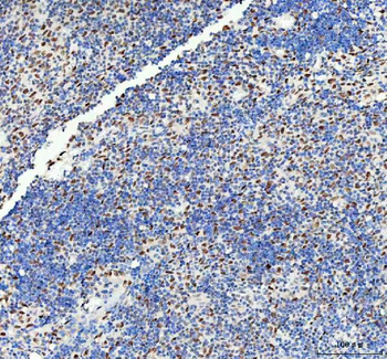 DDX1 Mouse Monoclonal Antibody