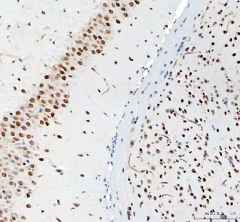 DDX1 Mouse Monoclonal Antibody