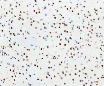 DDX1 Mouse Monoclonal Antibody
