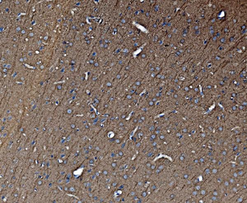 Tubulin alpha Mouse Monoclonal Antibody