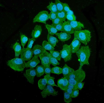 Tubulin alpha Mouse Monoclonal Antibody