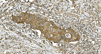 Tubulin alpha Mouse Monoclonal Antibody