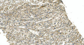 Tubulin alpha Mouse Monoclonal Antibody
