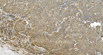 Tubulin alpha Mouse Monoclonal Antibody