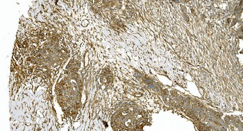 Tubulin alpha Mouse Monoclonal Antibody