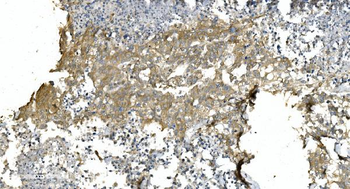 Tubulin alpha Mouse Monoclonal Antibody