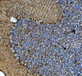 Tubulin alpha Mouse Monoclonal Antibody