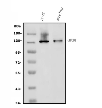 P Glycoprotein/ABCB1 Rabbit Polyclonal Antibody