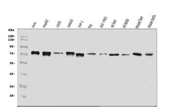 ADAMTS5 Rabbit Polyclonal Antibody