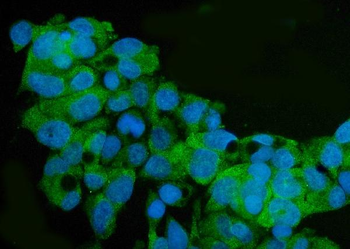 ARG2 Rabbit Polyclonal Antibody