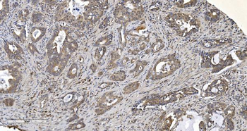 ARG2 Rabbit Polyclonal Antibody