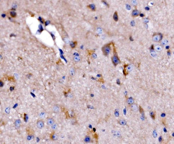 ATG9A Rabbit Polyclonal Antibody