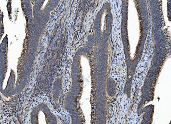 Caspase-7/CASP7 Rabbit Polyclonal Antibody