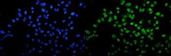 VPRBP/DCAF1 Rabbit Polyclonal Antibody