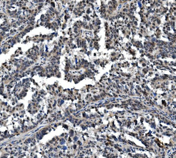 VPRBP/DCAF1 Rabbit Polyclonal Antibody