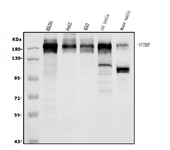 VPRBP/DCAF1 Rabbit Polyclonal Antibody