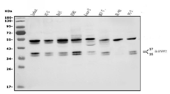 HNRNPH3 Rabbit Polyclonal Antibody