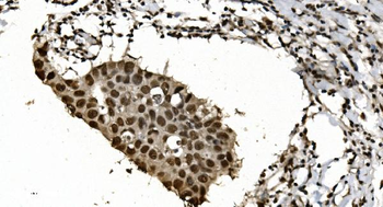 HNRNPH3 Rabbit Polyclonal Antibody