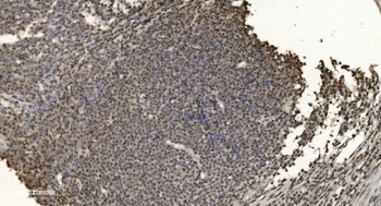 HNRNPH3 Rabbit Polyclonal Antibody