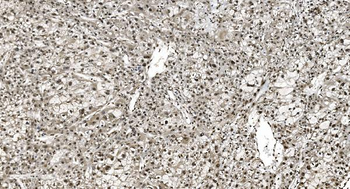 HNRNPH3 Rabbit Polyclonal Antibody
