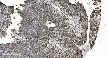 HNRNPH3 Rabbit Polyclonal Antibody