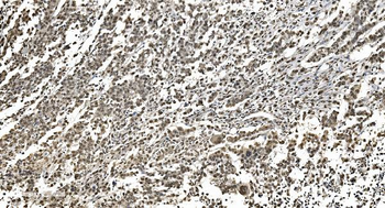 HNRNPH3 Rabbit Polyclonal Antibody