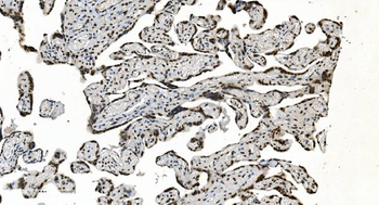 HNRNPH3 Rabbit Polyclonal Antibody