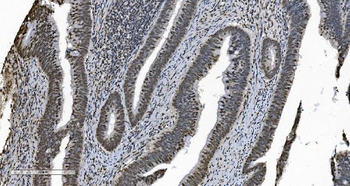 HNRNPH3 Rabbit Polyclonal Antibody