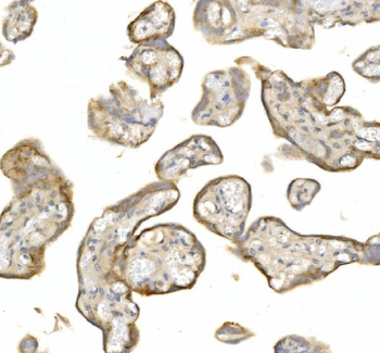 LY6E/SCA-2/SCA Rabbit Polyclonal Antibody