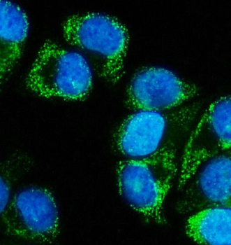 MEK5/MAP2K5 Rabbit Polyclonal Antibody