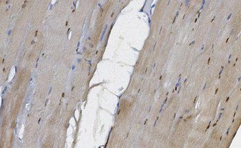 MEK5/MAP2K5 Rabbit Polyclonal Antibody