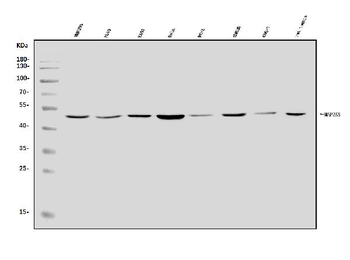 MEK5/MAP2K5 Rabbit Polyclonal Antibody