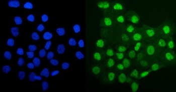 MCM4 Rabbit Polyclonal Antibody