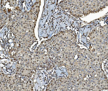 MCM4 Rabbit Polyclonal Antibody